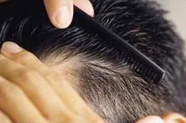 مهمترین علت ریزش مو چیست؟