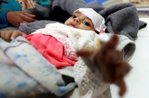 طرف‌های درگیر در یمن عامل شیوع «وبا» هستند