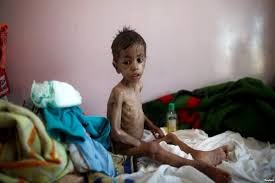 افزایش شمار قربانیان وبا در یمن؛ ائتلاف سعودی: گزارش صلیب سرخ اغراق‌آمیز است